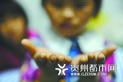 指尖被針扎得傷痕累累。