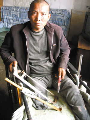 鄭艷良就是用這幾樣簡(jiǎn)陋工具，給自己做了右腿截肢手術(shù)。