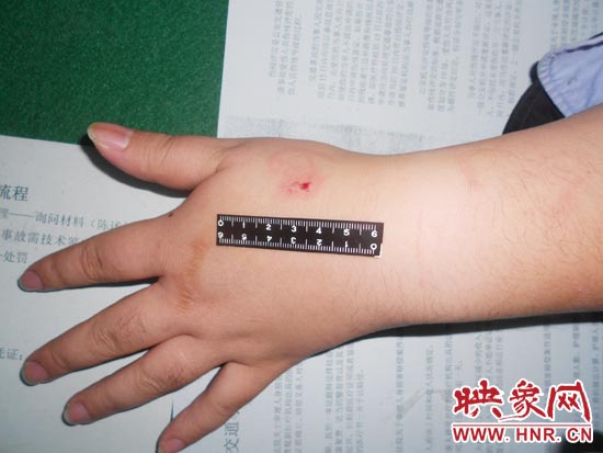 為幫助無證駕駛的朋友逃避處罰，新鄉(xiāng)的王某竟對(duì)執(zhí)勤民警大打出手，還將一名民警的手臂咬傷