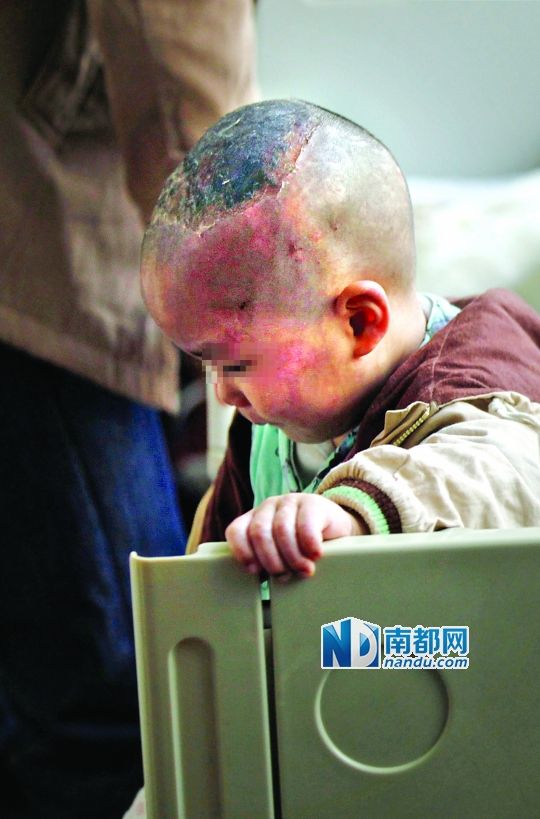 1月8日下午，小寶頭上和臉上都是傷痕。